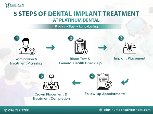 How long does it take to implant a tooth?