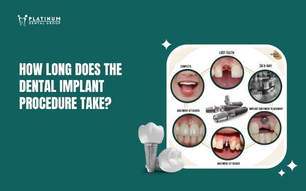 how long does the dental implant process take