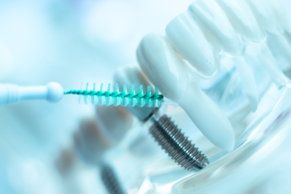 Water flossers and interdental brushes are essential for cleaning hard-to-reach areas
