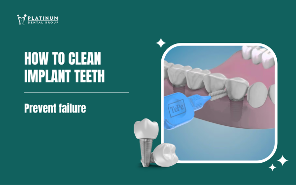 how to clean implant teeth