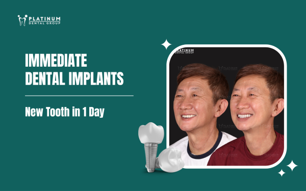 immediate dental implants