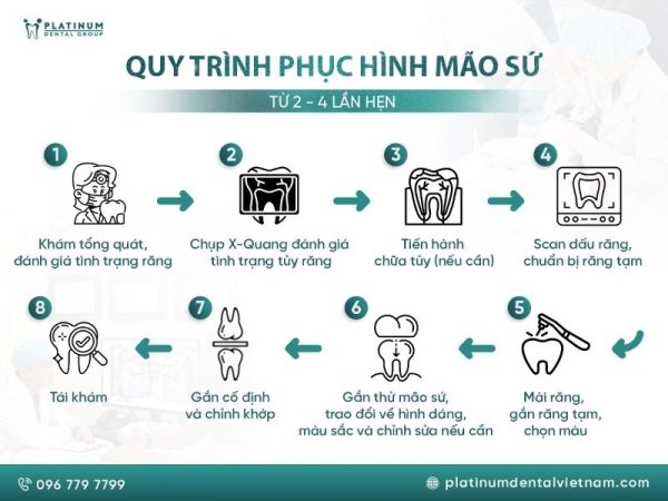 Mài răng bọc sứ: Quy trình, rủi ro và địa chỉ uy tín 3 Quy trình mài răng bọc sứ chuẩn nha khoa: thăm khám – mài răng – lấy dấu – gắn thử – hoàn tất