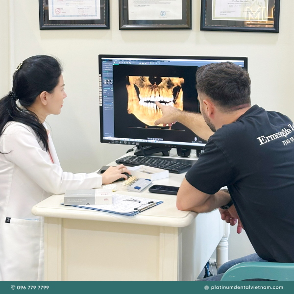 Mất chân răng là gì? Nguyên nhân, hậu quả và cách khắc phục hiệu quả 10 Bác sĩ tư vấn về giải pháp và chi phí cấy Implant khi mất chất răng cho bệnh nhân