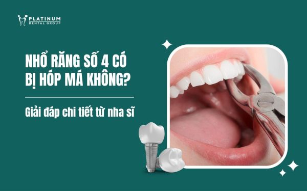 nhổ răng số 4 có bị hóp má không