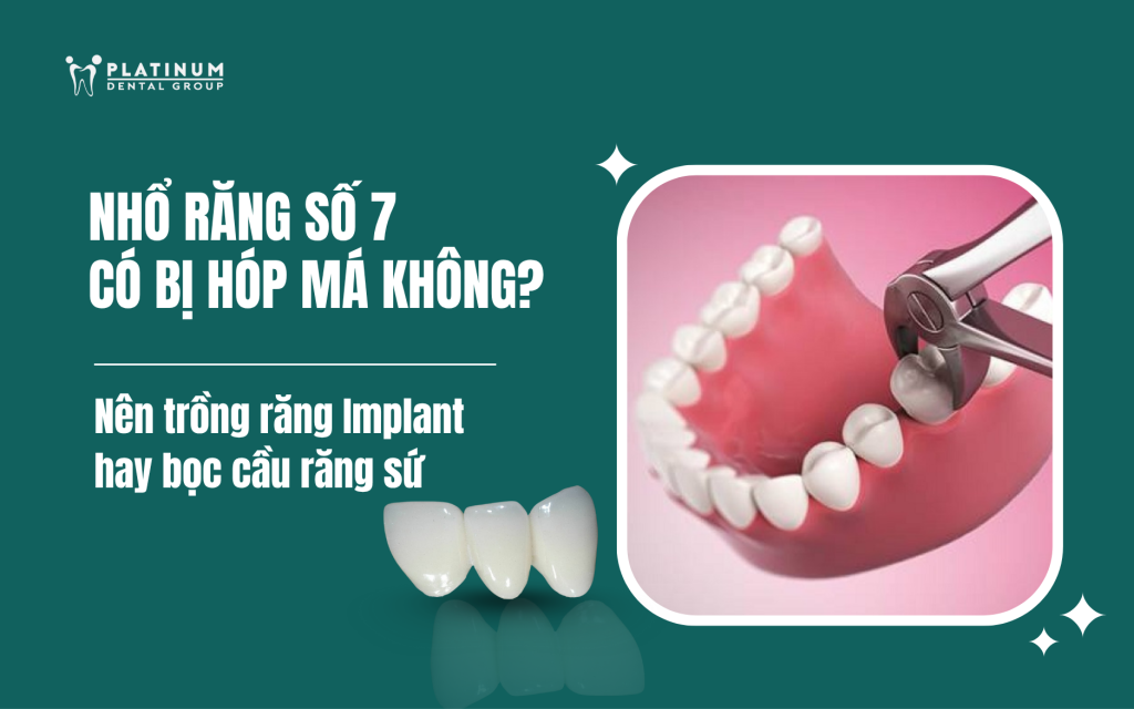 nhổ răng số 7 có bị hóp má không