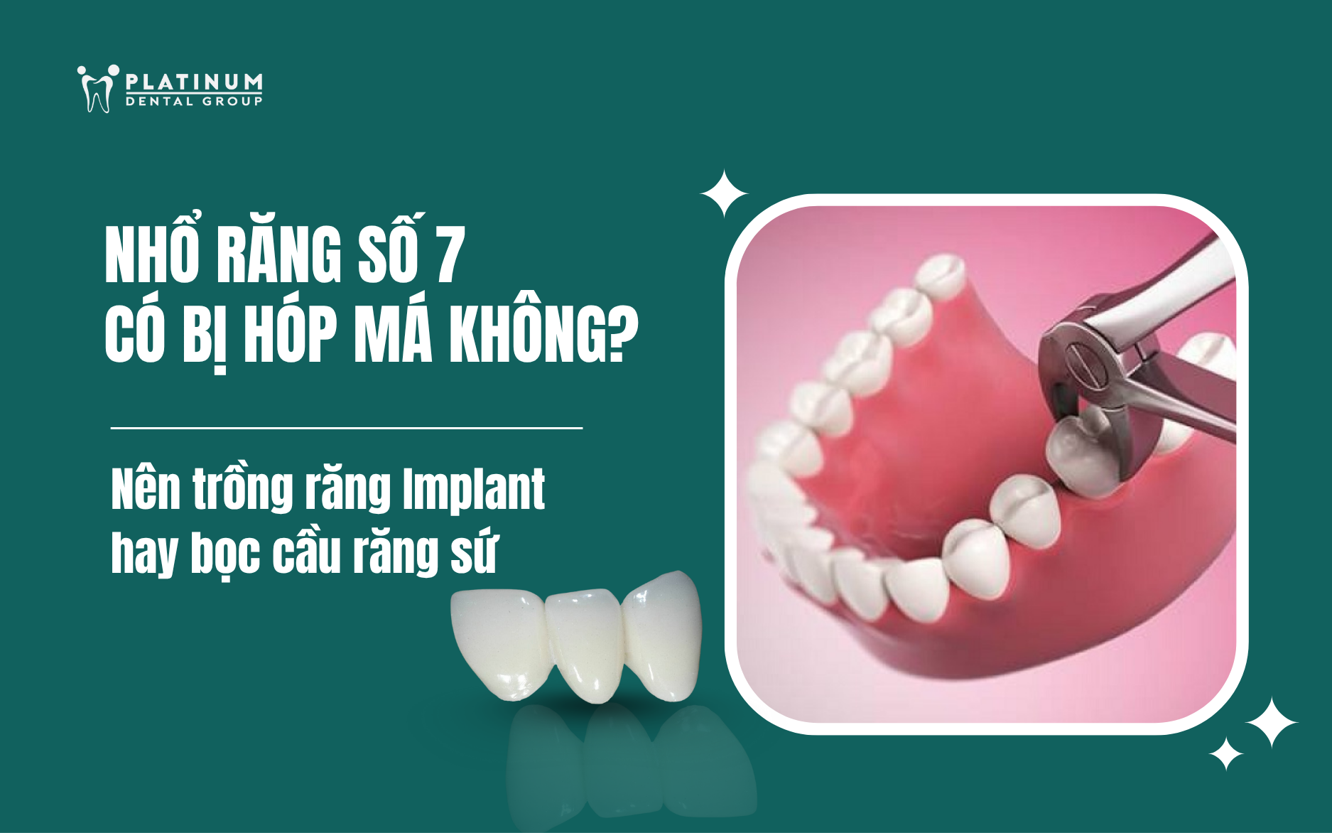 nhổ răng số 7 có bị hóp má không