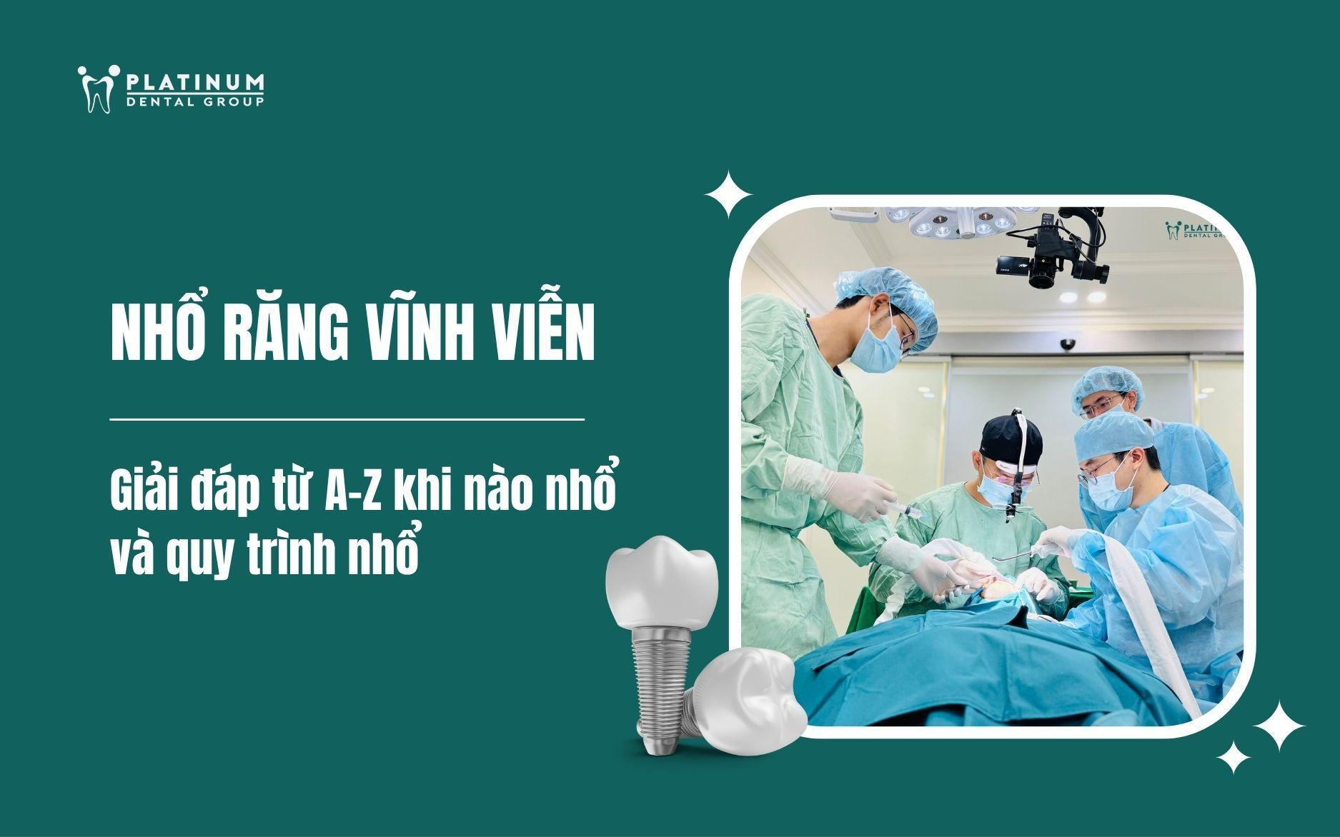 Nhổ răng vĩnh viễn