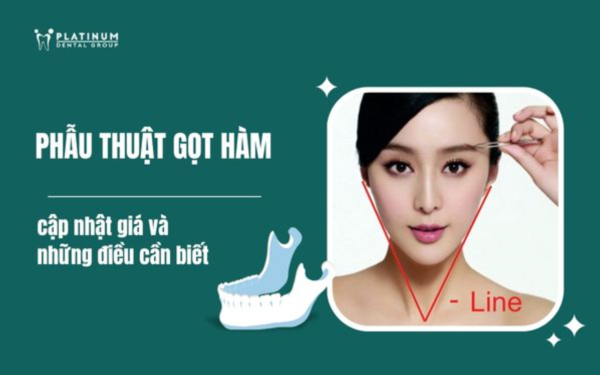 phẫu thuật gọt hàm