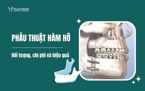 phẫu thuật hàm hô