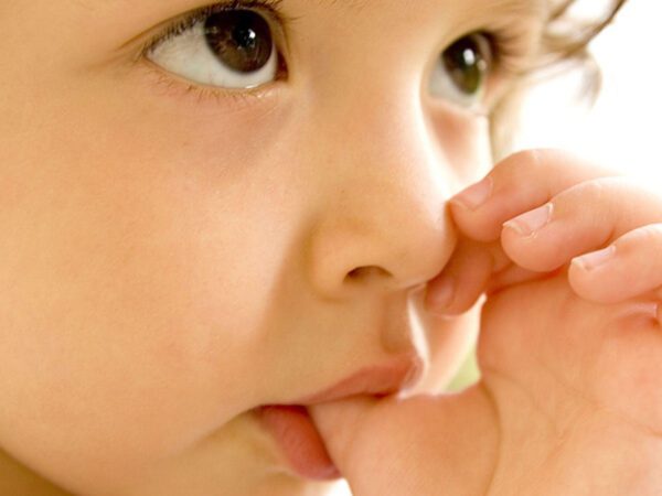 Thói quen mút tay trong giai đoạn tiền thay răng cũng có thể là nguyên nhân gây ra tình trạng hàm móm