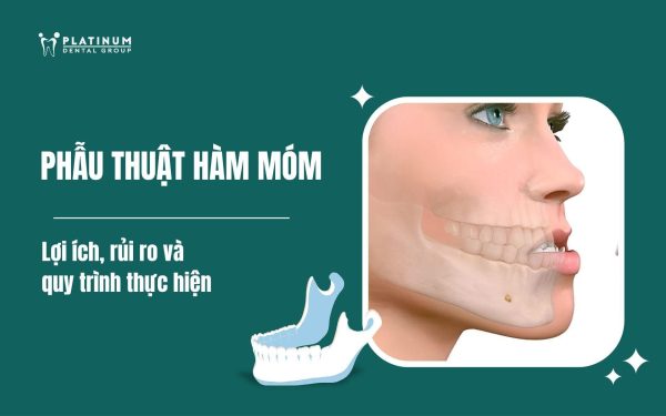 phẫu thuật hàm móm
