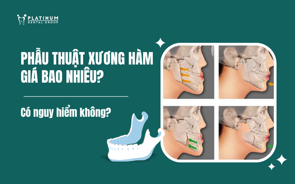 phẫu thuật xương hàm