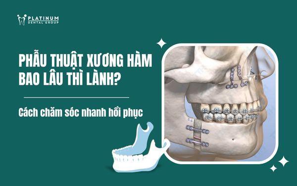 phẫu thuật xương hàm bao lâu thì lành