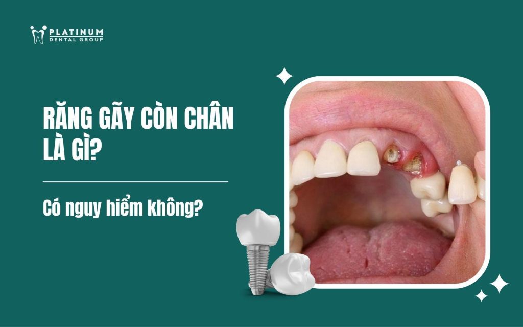 răng gãy còn chân