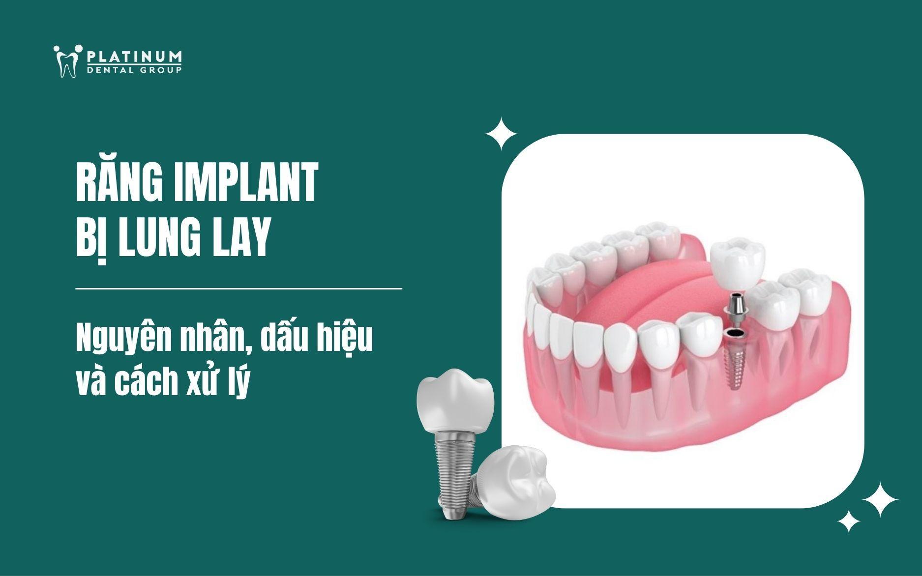 răng implant bị lung lay