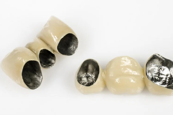 Răng sứ Crom Cobalt là sự kết hợp giữa khung sườn kim loại vững chắc và lớp sứ có màu sắc tự nhiên