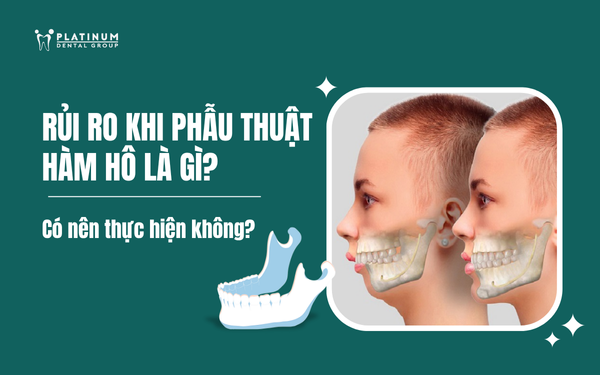 rủi ro khi phẫu thuật hàm hô