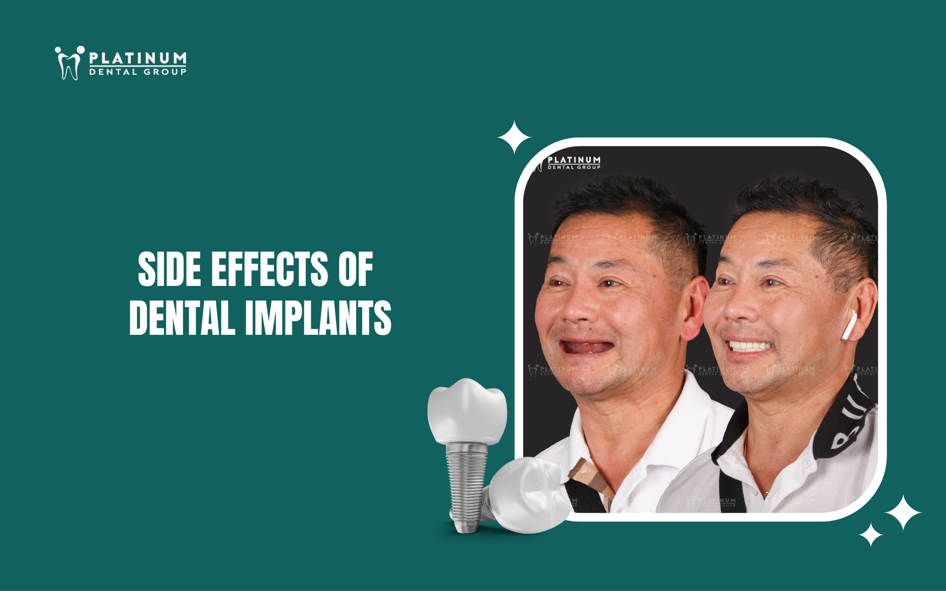 side effects of dental implants