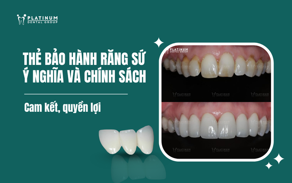 thẻ bảo hành răng sứ