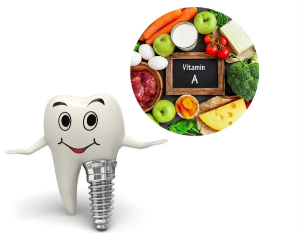 Sau trồng răng Implant bao lâu thì ăn uống bình thường?