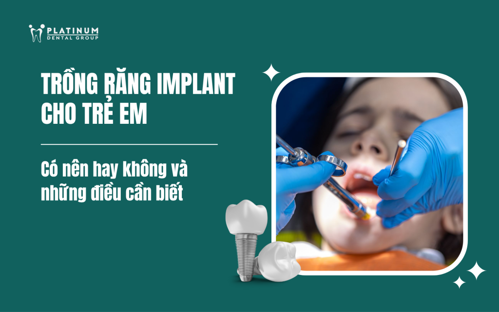 trồng răng implant cho trẻ em