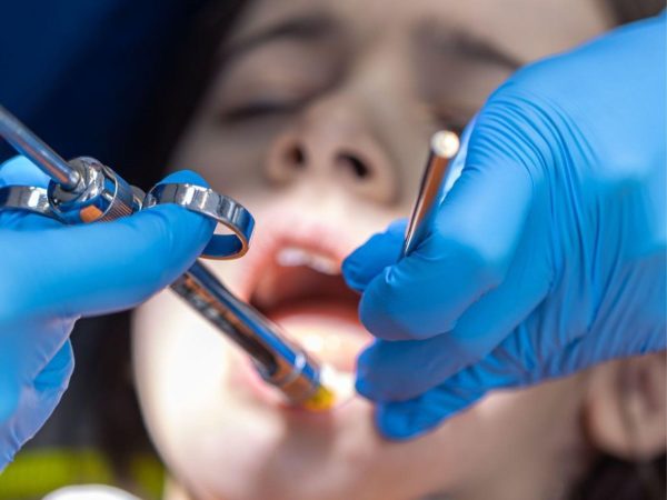 Trồng răng Implant cho trẻ em: Có nên hay không và những điều cần biết 1 Trồng răng Implant cho trẻ em được không?