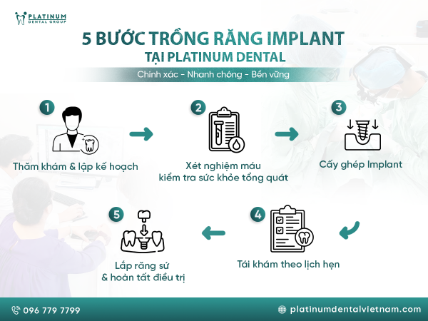 Quy trình trồng răng Implant tại Platinum Dental Group an toàn tuyệt đối