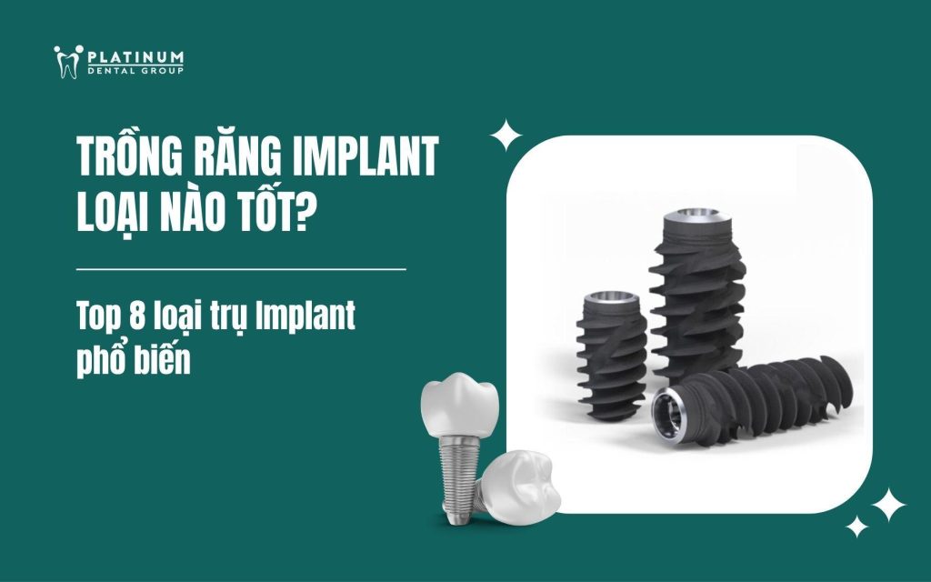 trồng răng implant loại nào tốt