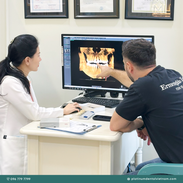 Phục hồi răng mất bằng phương pháp cầu răng sứ phù hợp với trường hợp mất răng ít