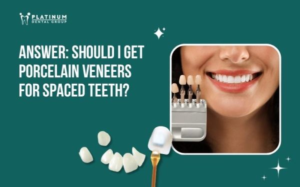 veneers for spaced teeth