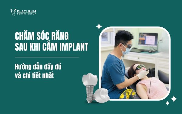 chăm sóc răng sau khi cắm implant