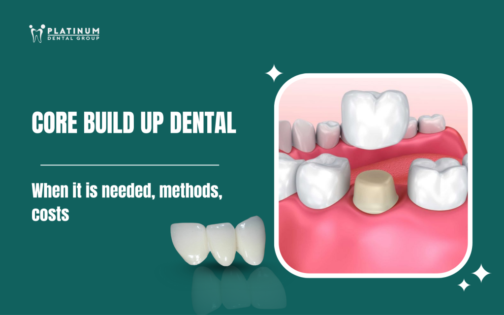 core build up dental