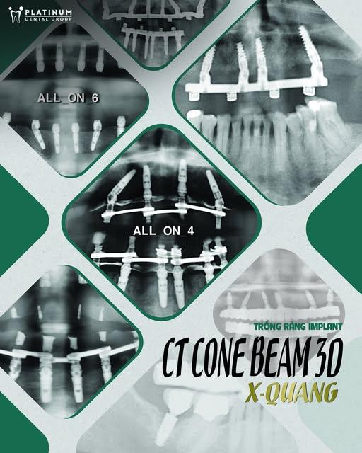 CT Cone Beam được dùng trong những trường hợp nào?