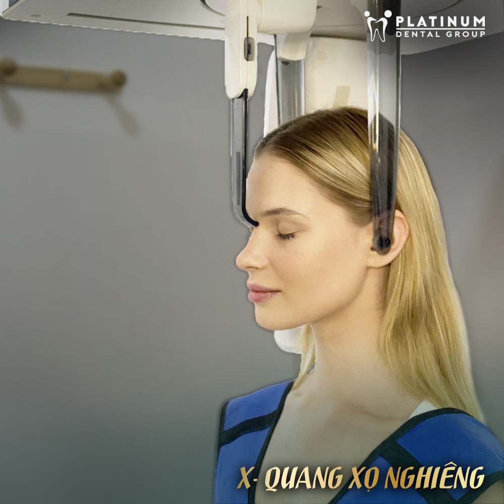 Platinum Dental Group áp dụng CT Cone Beam trong chẩn đoán và điều trị