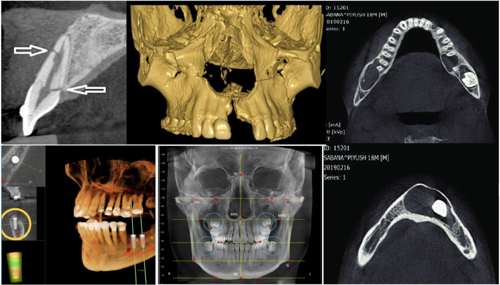 CBCT cung cấp hình ảnh 3D toàn diện của răng, xương hàm và các cấu trúc liên quan