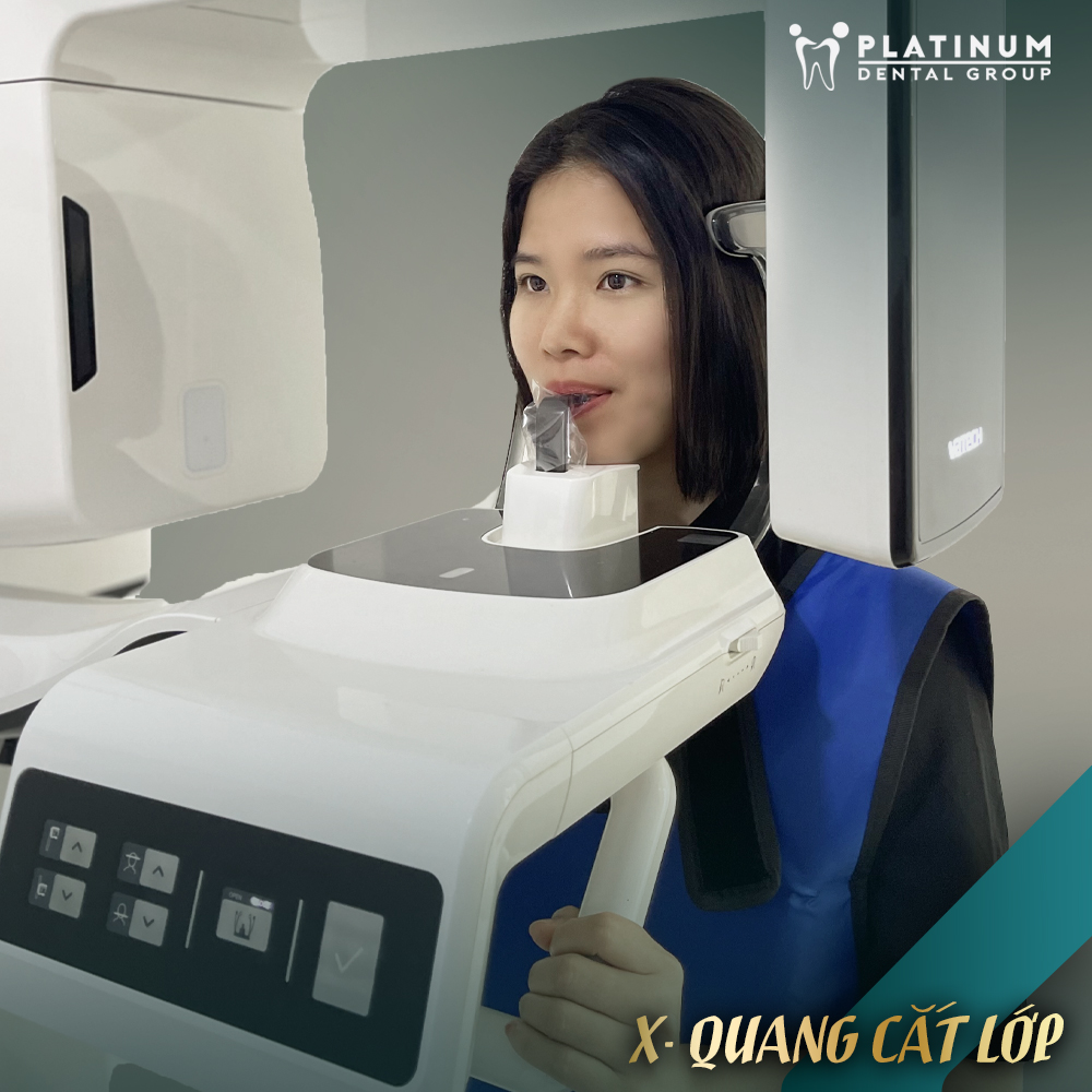 Nghiến răng: Nguyên nhân, dấu hiệu và cách điều trị hiệu quả 7 Chụp CT Cone Beam để chẩn đoán tình trạng nghiến răng