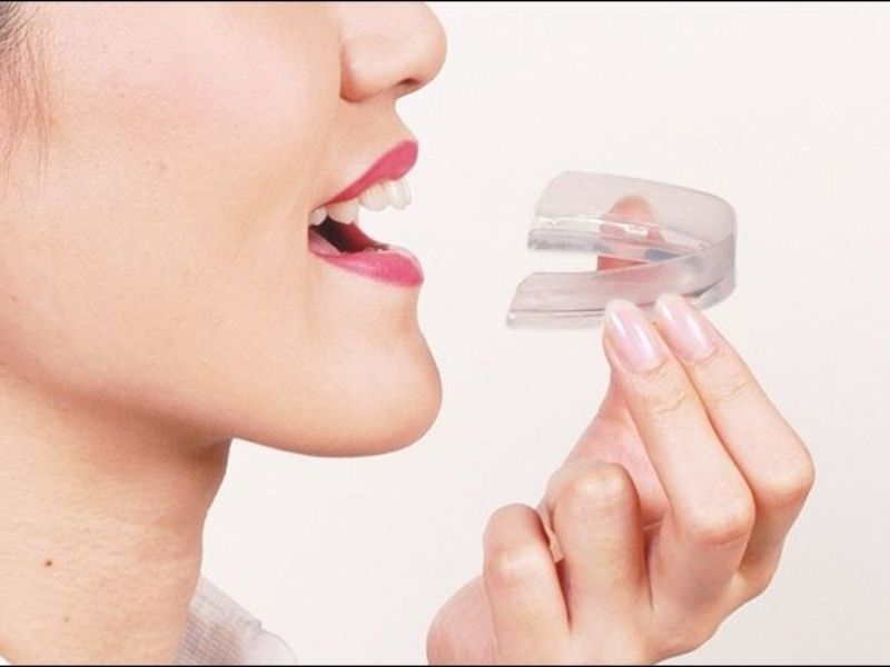 Nghiến răng: Nguyên nhân, dấu hiệu và cách điều trị hiệu quả 8 Chữa nghiến răng bằng cách mang máng chống nghiến