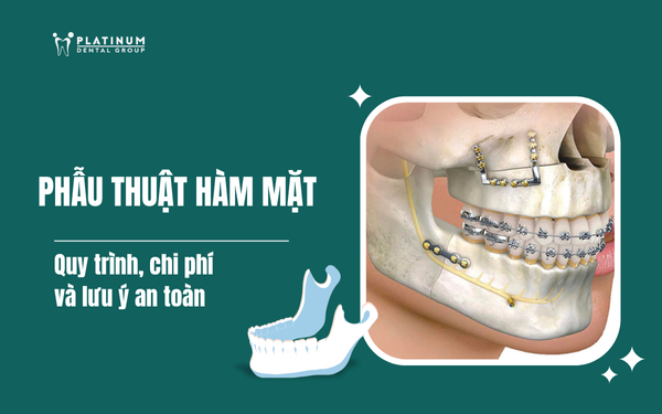 phẫu thuật hàm mặt