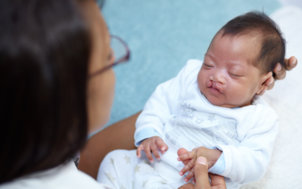 Phẫu thuật hàm mặt giúp điều trị dị tật bẩm sinh như sứt môi, hở hàm ếch, tái tạo khuôn mặt cân đối và cải thiện chức năng phát âm