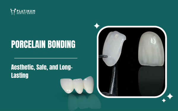 porcelain bonding