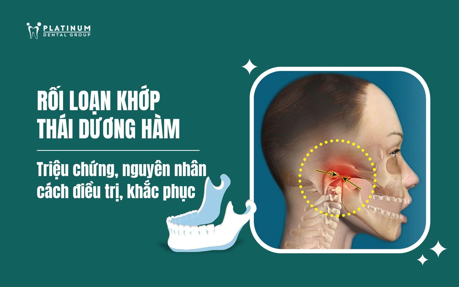 rối loạn khớp thái dương hàm