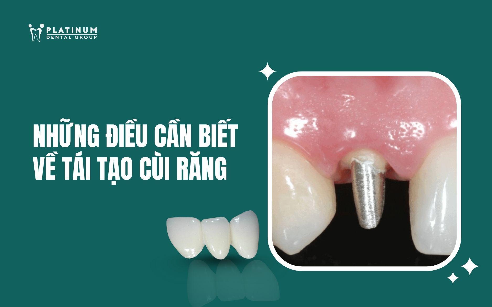 tái tạo cùi răng