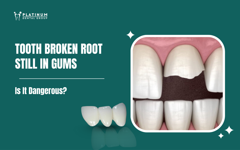 tooth broken root still in gums