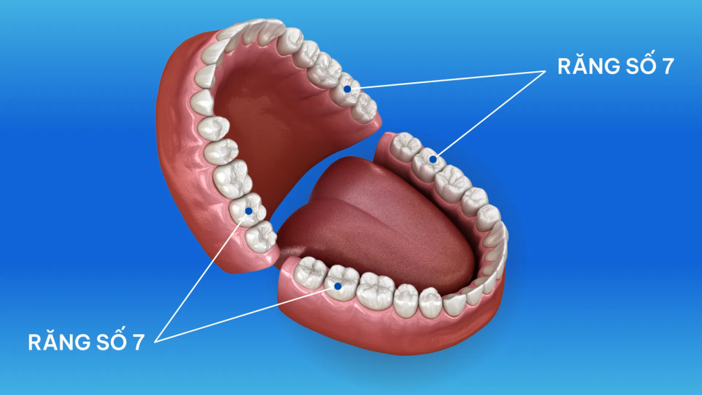 Mất răng số 7 không chỉ ảnh hưởng đến khả năng nhai mà còn có thể gây ra nhiều vấn đề về sức khỏe răng miệng