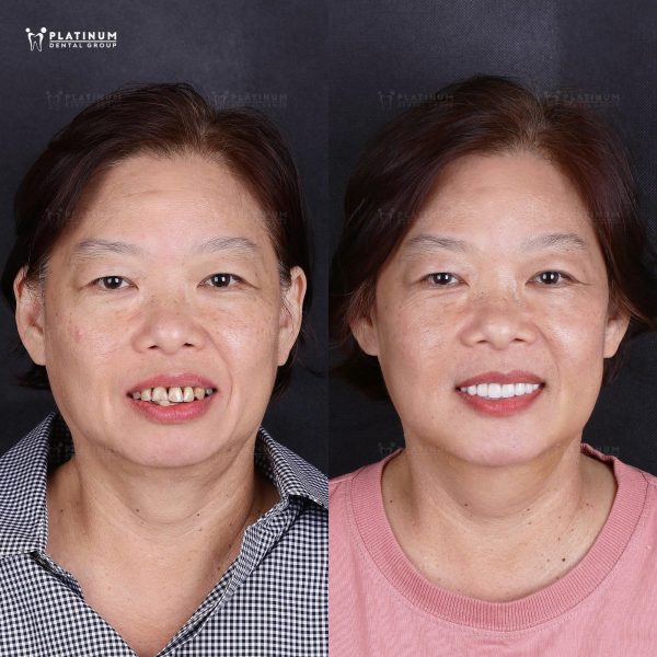 Showcase-co-Vi-Khanh3