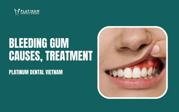 bleeding gum