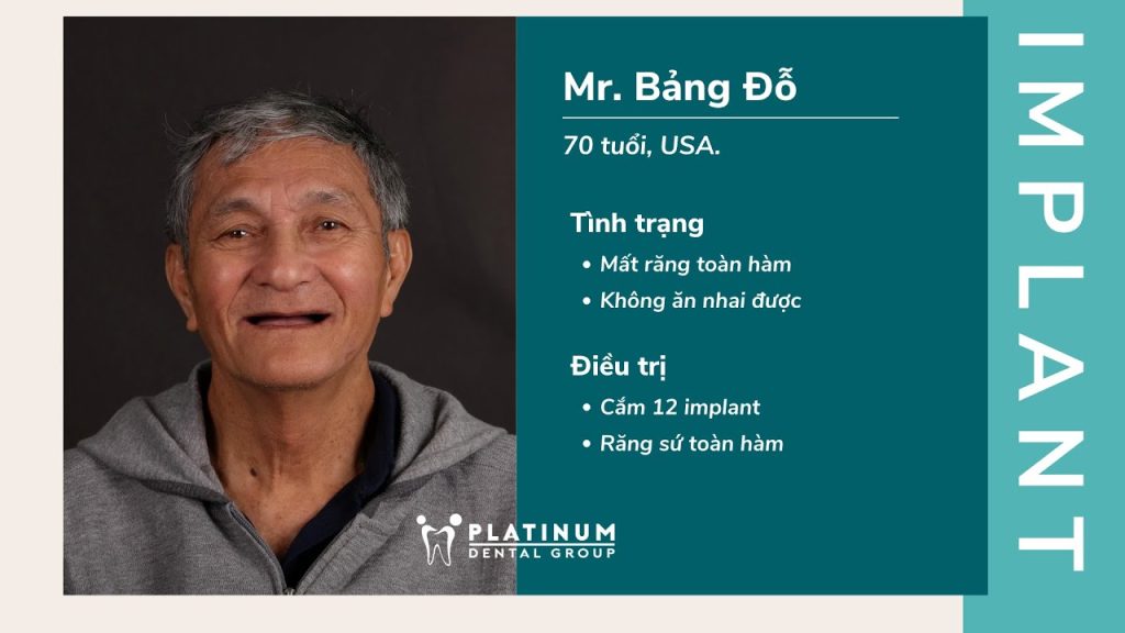 CẤY GHÉP 12 IMPLANT Ở TUỔI 70 QUYẾT ĐỊNH GIÚP CHÚ BẢNG ĐỖ ĂN NGON, SỐNG KHỎE HƠN