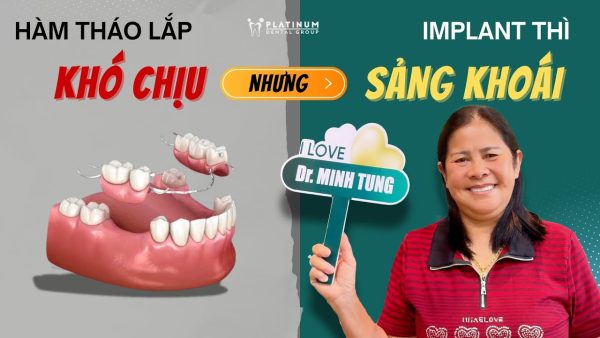 Có RĂNG TẠM NGAY SAU CẤY IMPLANT - "SẢNG KHOÁI" tức thì
