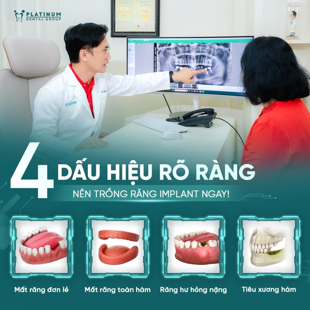 dau-hieu-nen-trong-rang-implant