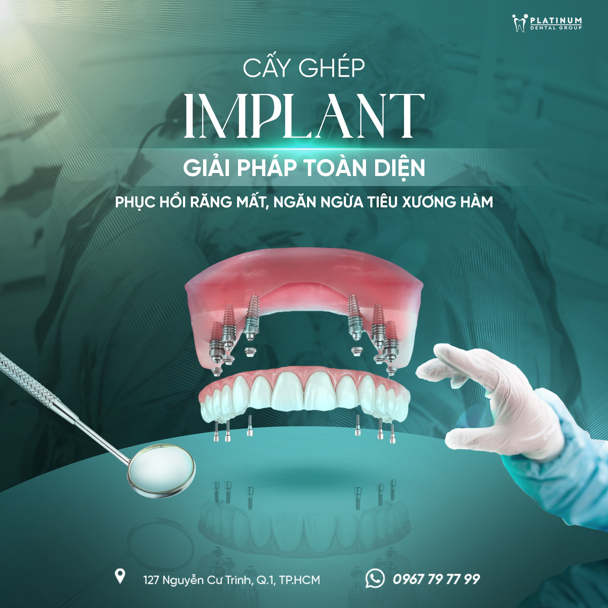 dich-vu-trong-rang-implant